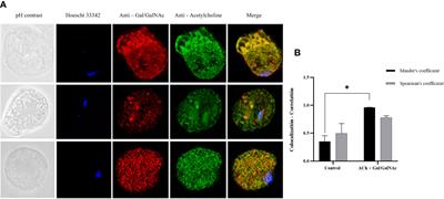 The Gal/GalNac lectin as a possible acetylcholine receptor in Entamoeba histolytica